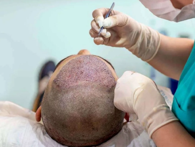 کلینیک فوق تخصصی کاشت مو و زیبایی تندیس سلامت در مشهد