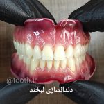 دندانسازی لبخند در بندرعباس